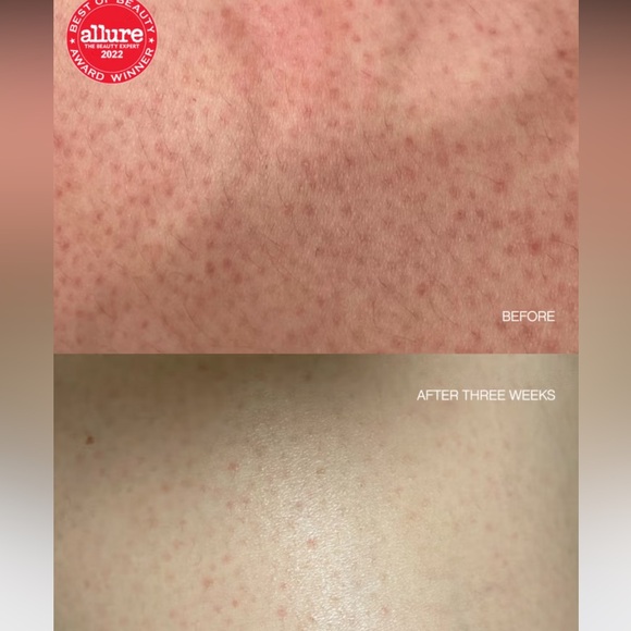 Topicals Slather Exfoliating Body Serum with retinol, AHA’s, Squalane - Picture 5 of 8